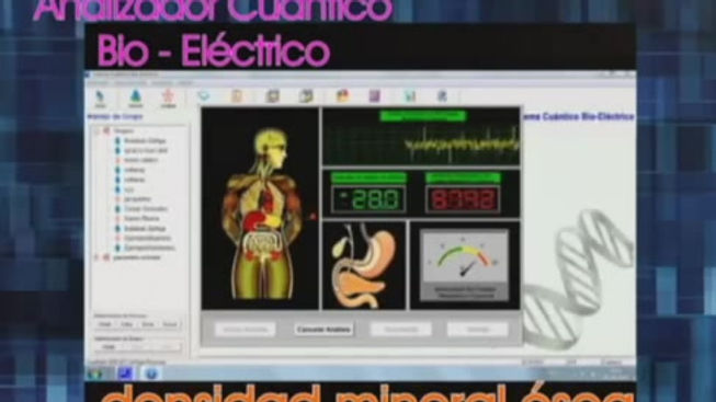 ANALIZADOR CUÁNTICO BIO ELÉCTRICO (BIOMAGNÉTICO)